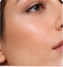 Facial support assessment