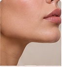 Lower face assessment