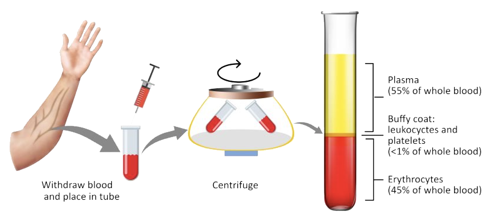 Platelet rich plasma extraction